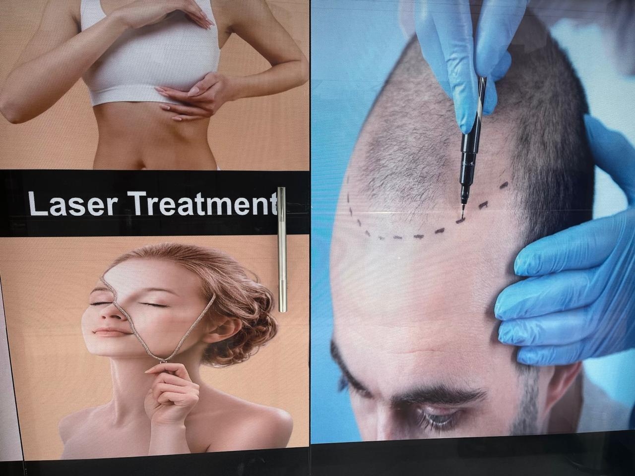 Cosmetic, laser and hair treatment display at the Aesthera entrance